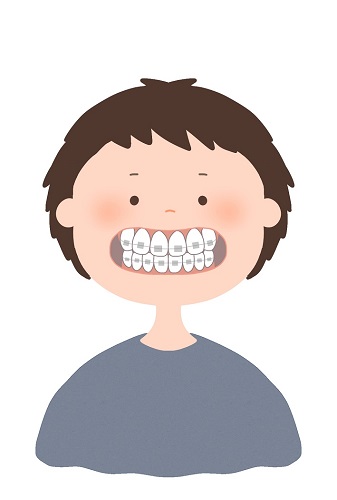 矯正歯科治療を受けるにあたり、一般歯科医院と矯正歯科専門医院のどちらを選べばよいですか？